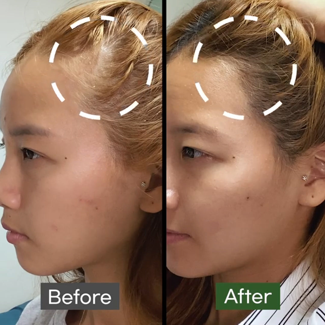 Some By Mi Cica Peptide Anti Hair Loss Derma Scalp Tonic - Σπρέι-τόνερ κατά της τριχόπτωσης