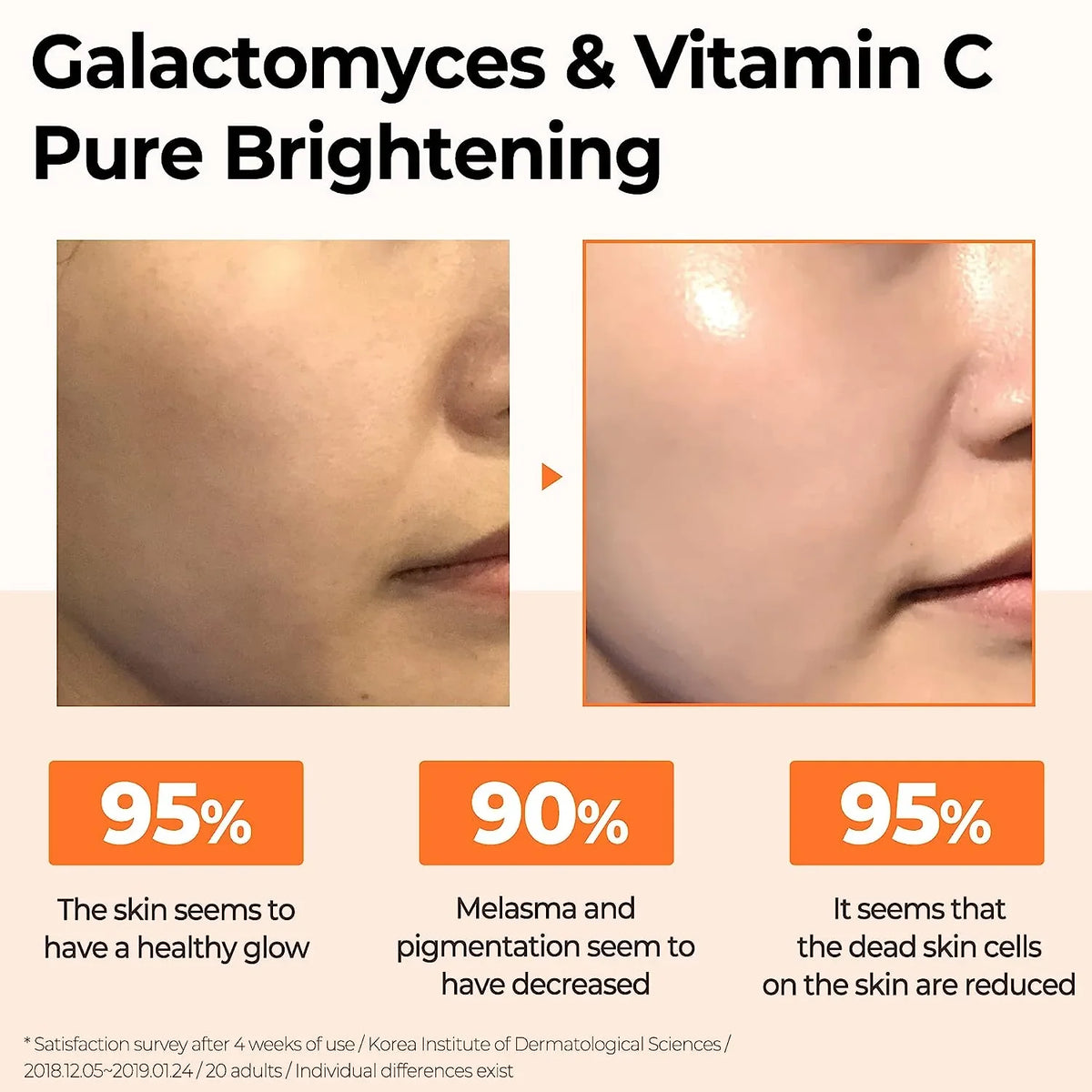 Some By Mi Galactomyces Pure Vitamin C Glow Serum - Serum Προσώπου για Λάμψη με Βιταμίνη C και γαλακτομύκητα