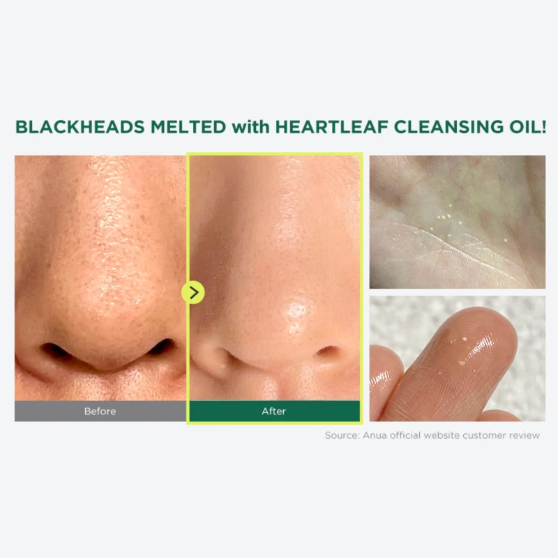 Anua Heartleaf Pore Control Cleansing Oil 200ml - Έλαιο για βαθύ καθαρισμό των πόρων