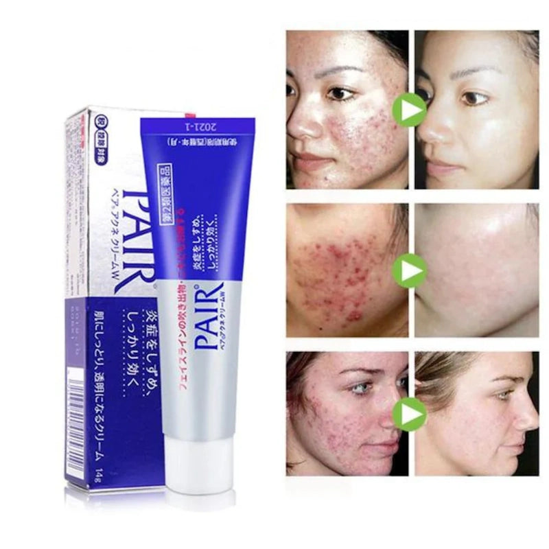 Lion Pair Acne Cream W - Κρέμα Προσώπου κατά της Ακμής & της Ερυθρότητας 24gr