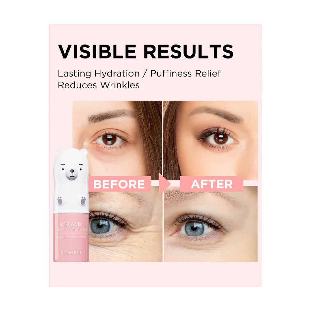 The Saem Iceland Hydrating Collagen Eye Stick - Θεραπεία ματιών για ενυδάτωση, σύσφιξη και μείωση των ρυτίδων