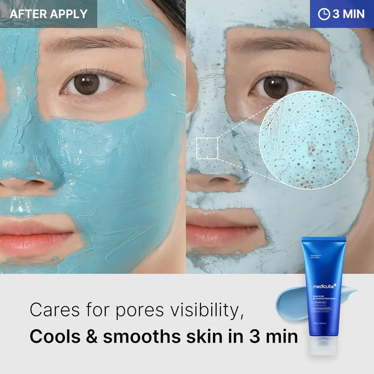 Medicube Zero Pore Blackhead Mud Mask 100g - Μάσκα Προσώπου για Σύσφιξη Πόρων με Άργιλο